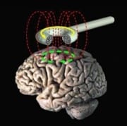 TMS-schematic-featured-copy